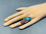 Best Vintage Native American Navajo Old Kingman Turquoise Coral Sterling Silver Ring-Nativo Arts