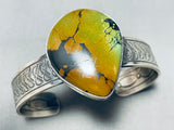 Native American Breathtaking Vintage Frogskin Turquoise Sterling Silver Bracelet-Nativo Arts