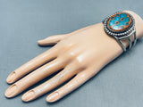 The Most Unique Vintage Native American Navajo Turquoise Walnut Inlay Sterling Silver Bracelet-Nativo Arts