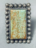 Massive Vintage San Felipe Green Turquoise Sterling Silver Button Ring