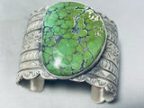 Frogskin Turquoise 100+ Gram Native American Navajo Sterling Silver Bracelet-Nativo Arts