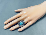 Tc Exceptional Vintage Native American Navajo Morenci Turquoise Sterling Silver Ring