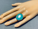 Impressive Native American Navajo Signed Kingman Turquoise Large Sterling Silver Ring-Nativo Arts