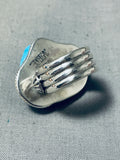 Important Ben Begaye (d.) Vintage Native American Navajo Hand Carved Toad Turquoise Ring-Nativo Arts