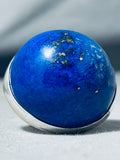 One Of The Largest Ever Native American Navajo Lapis Sterling Silver Bulbous Ring-Nativo Arts