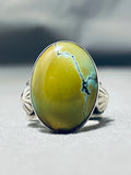 Rare Native American Navajo Signed Frogskin Turquoise Sterling Silver Large Ring-Nativo Arts