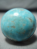 Huge Bulbous Domed Native American Navajo Pilot Mountain Turquoise Sterling Silver Ring-Nativo Arts