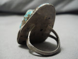 One Of The Biggest Vintage Native American Navajo Turquoise Sterling Silver Ring Old-Nativo Arts