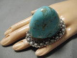 Mind Blowing Colossal Protruding Native American Navajo #8 Turquoise Sterling Silver Ring-Nativo Arts