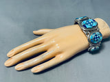 One Of The Most Unique Ever Native American Navajo Turquoise Inlay Sterling Silver Bracelet-Nativo Arts