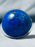 One Of The Largest Ever Native American Navajo Lapis Sterling Silver Bulbous Ring-Nativo Arts