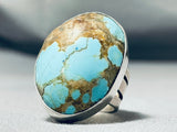 Huge Bulbous Native American Turquoise #8 Sterling Silver Ring-Nativo Arts
