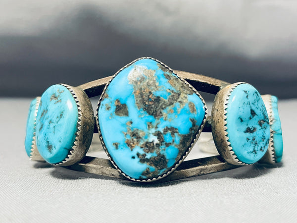 Native-American-Hoskie-Yazzie-