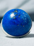 One Of The Largest Ever Native American Navajo Lapis Sterling Silver Bulbous Ring-Nativo Arts