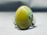 Rare Native American Navajo Signed Frogskin Turquoise Sterling Silver Large Ring-Nativo Arts
