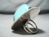 Biggest Ever Native American Navajo Morenci Turquoise Sterling Silver Ring-Nativo Arts
