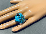 Important Ben Begaye (d.) Vintage Native American Navajo Hand Carved Toad Turquoise Ring-Nativo Arts
