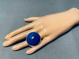 One Of The Largest Ever Native American Navajo Lapis Sterling Silver Bulbous Ring-Nativo Arts