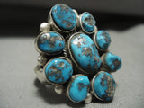 Huge And Important Vintage Navajo Verdy Jake Old Morenci Turquoise Native American Jewelry Silver Ring-Nativo Arts
