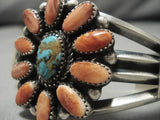 Jeanette Dale!! Native American Navajo Sterling Silver Turquoise Spiny Oyster Bracelet-Nativo Arts